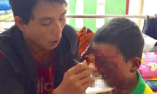 Em Xuyên nguy cơ hỏng mắt nếu không được chuyển viện gấp.