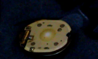 "Vật lạ" được gắn trong áo bé Minh là chíp điện tử nhằm phát sáng?