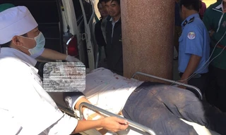 Nạn nhân được chuyển lên tuyến trên với nguyên cành cà phê trong hốc mắt