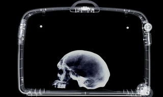 Máy quét an ninh phát hiện có hộp sọ người trong hành lý của ông giáo sư. Ảnh: Stuff