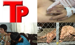 Bản tin Hình sự: Tin mới vụ cụ bà bị chó dữ cắn chết