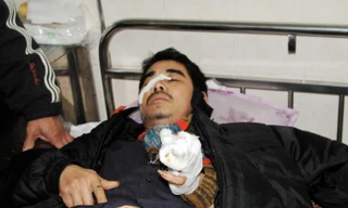 Giọt nước mắt của người cha bị con đánh