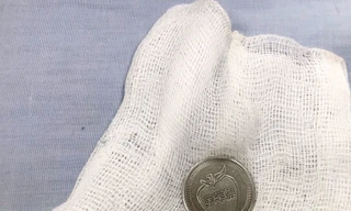 Đồng xu được gắp ra ngoài.