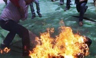 Mâu thuẫn gia đình, con tưới xăng đốt cha khiến 4 người bị bỏng nặng. Ảnh minh họa