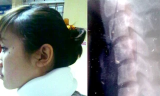 Chủ tịch CLB BĐS Hà Nội bị tố đánh con trật xương cổ