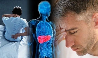 Tỷ lệ mắc ung thư gan ở Việt Nam đứng thứ 3 thế giới