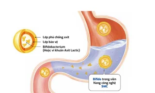 Bụng êm ru, hết trướng bụng đầy hơi, thoát nỗi khổ viêm đại tràng sau nhiều năm 