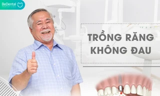 Bảng giá trồng răng implant mới cập nhật 2022 tại nha khoa thẩm mỹ Bedental