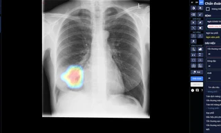 DrAid – Công cụ sàng lọc và tiên lượng điều trị COVID-19 ứng dụng AI đầu tiên tại Việt Nam