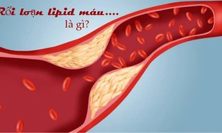 Lipidcleanz - Công thức thảo dược cho người rối loạn lipid máu!