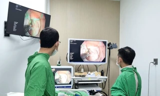 Bác sĩ trẻ tiên phong đưa kỹ thuật can thiệp ung thư sớm đường tiêu hóa qua nội soi về Tây Nguyên 