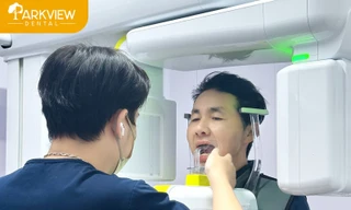 Parkview Dental - Nha khoa tiên phong trong ứng dụng các giải pháp tiên tiến trong trồng răng Implant 