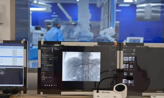 Nút mạch điều trị ung thư gan nhẹ nhàng, ít tác dụng phụ với phương pháp hạt ngậm hóa chất hiện đại 