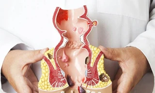 Viên sủi Satuchin - Hỗ trợ điều trị bệnh trĩ hiệu quả