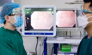 Nhẹ mối lo ung thư nhờ công nghệ nội soi tiêu hóa hiện đại