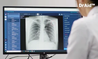 VinBrain lọt vòng chung kết cuộc thi toàn cầu “Thử thách ứng phó với đại dịch”