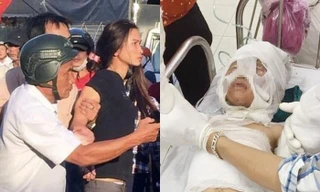 Dì tưới xăng thiêu sống cháu 6 tuổi để đòi nợ?