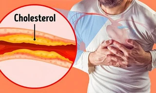 Vì sao Nattokinase Jintan hỗ trợ ‘hạ mỡ máu, ngăn tai biến’ hiệu quả