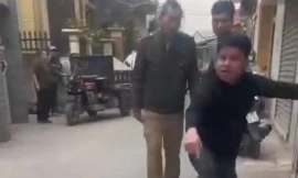 Hà Nội: Xác minh thông tin thả chó cắn vào mặt, chân người phụ nữ đi đường