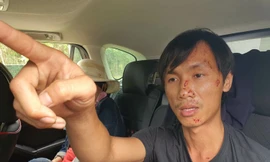 Vụ tai nạn thảm khốc ở Bình Thuận: Tài xế xe tải được đưa ra Nha Trang chụp chân