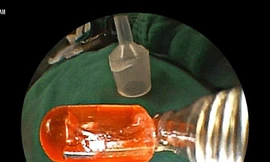 Trẻ nhỏ dễ hóc di vật do sự bất cẩn của phụ huynh