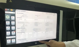 Bệnh viện Chợ Rẫy khai trương hệ thống xét nghiệm chẩn đoán sinh học phân tử hiện đại