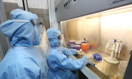 Bộ test KIT phát hiện SARS-CoV-2 made in Việt Nam