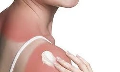 Nắng nóng cực điểm: Cảnh báo bỏng nắng và bệnh da tăng cao