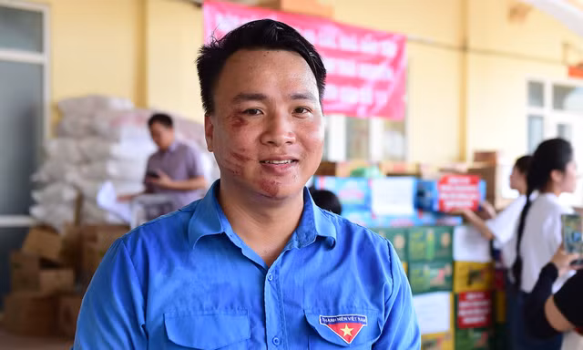 Vết thương trên mặt của Bí thư đoàn phường ở 'rốn lũ' Thái Nguyên