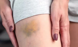 Ảnh minh họa: Internet