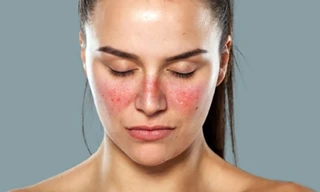 Ảnh minh họa: Internet