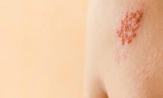 Ảnh minh họa: Internet