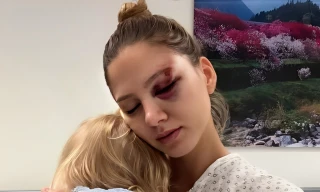 Hoa hậu 25 tuổi gặp tai nạn giao thông nghiêm trọng