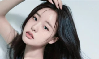 Á hậu rơi vào tình huống khó xử