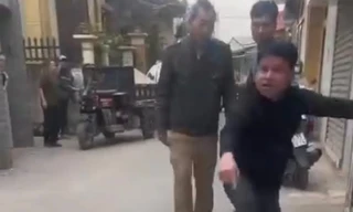 Hà Nội: Xác minh thông tin thả chó cắn vào mặt, chân người phụ nữ đi đường