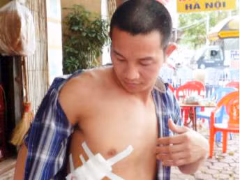 Một nghi can vụ xả súng truy sát chủ quán bia bị bắt