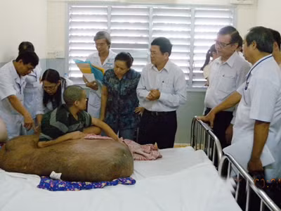 Rất khó phẫu thuật cho người mang khối u 80kg