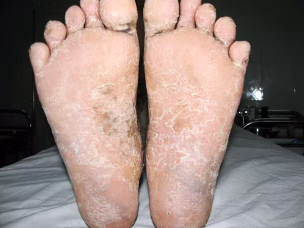 Điều tra nguyên nhân bệnh lạ ở Quảng Ngãi