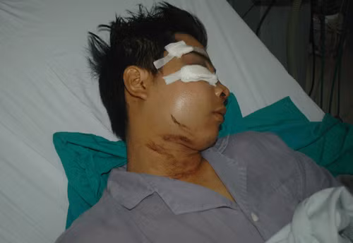 Tạm đình chỉ tổ 141 bị tố đánh dân