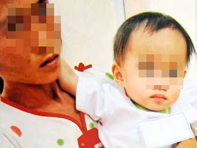 Hai mẹ con 'người rừng' đi giám định ADN