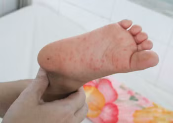 Thanh niên hưởng ứng phòng chống dịch tay chân miệng