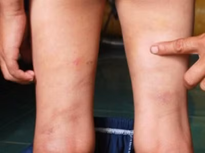 Bé 10 tuổi bị mẹ kế bạo hành suốt ba năm