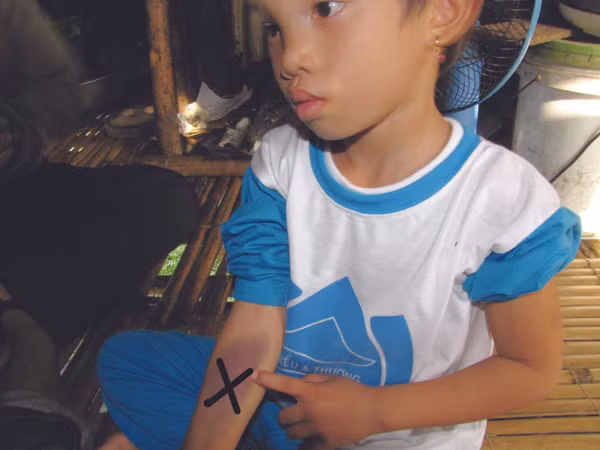 Đi từ trường về, cháu Ngân mang đầy thương tích