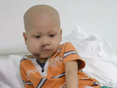 Cháu bé bị u mũi cần giúp đỡ