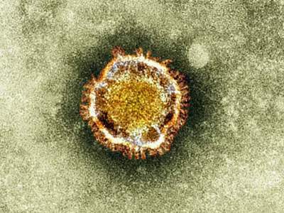 Virus mới tiếp tục giết người