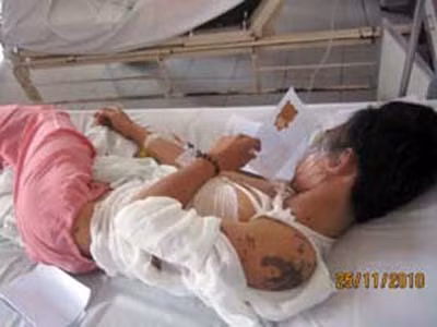 Đang chạy xe, thiếu nữ lãnh nguyên ca axit