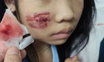 Cháu bé bị khỉ hoang tấn công khi chơi ở sân nhà
