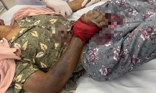 Uống thuốc dân gian sau khi bị rắn cắn, cụ bà 76 tuổi nguy kịch