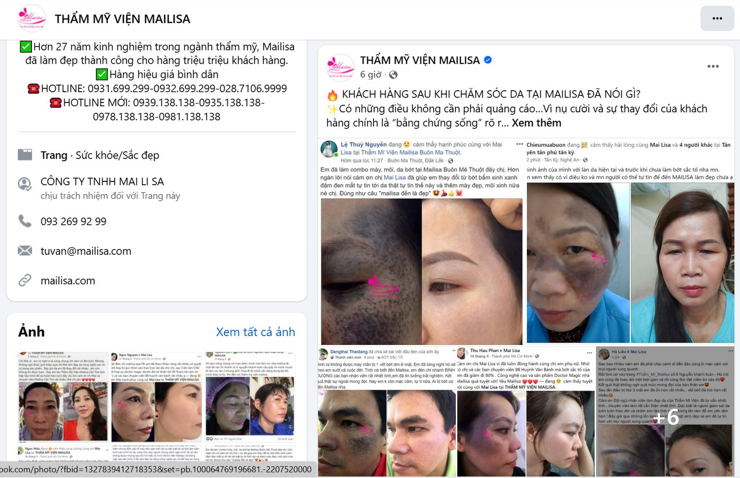 Mỹ phẩm Mailisa bị thu hồi: 'Tôi mua trọn bộ hơn 17 triệu đồng, giờ tìm ai đòi tiền?'
