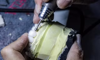 Những sai phạm khó tin sản xuất răng giả